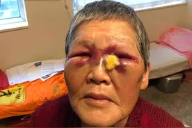 “抗争到死”，美华裔老太街头抗暴后，600万筹款全捐亚裔社区图片