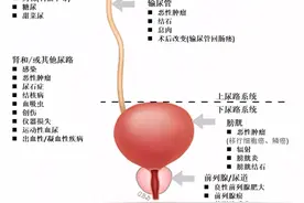 你，下面有血！血尿也分真假？图片