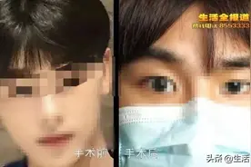 整容医院到底有多少套路？网红帅小伙在武汉一家医美整容“出事了”图片