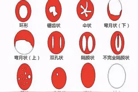 女人第一次会痛、会流血？关于这层膜的事，还有不少男女有误解图片