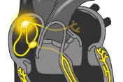 体检查出“窦性心律”是啥意思？心律不齐是心脏病吗？可算明白了图片