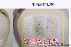 泡沫尿是肾脏有问题吗？图片
