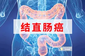 警惕这些症状，提早发现结直肠癌视频封面