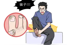 得了灰指甲，反复发作难根治？一次性介绍7种药，总有一款适合你图片