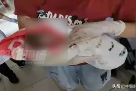 孕妇如厕时生产，情况紧急！幸好遇到了在邻居家做客的她图片