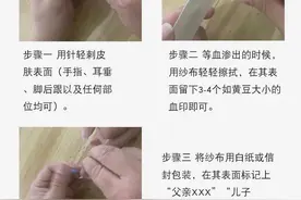 隐私亲子鉴定的常见生物类样本采集方法图片