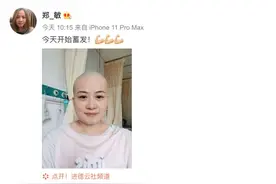 岳云鹏太太自曝入院手术，剃去一头长发图片