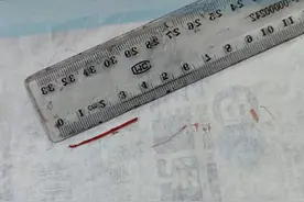 3.5厘米木刺扎入手掌，提醒：细小异物X片等很难排除，应及时就医图片