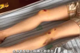 网约车两次改路线，女子跳车致多处挫伤骨折，平台：她应该看看脑子图片