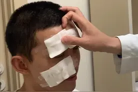 吴磊拍戏时意外炸伤脸！眼睛红肿伤口遍布全脸，导演吴京一脸担忧图片