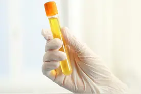 晨起时身体有5个迹象，说明体内尿酸盐已结晶，肾衰竭将不请自来图片