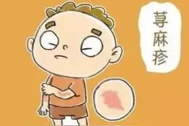 #健康科普汇#【什么是荨麻疹？】图片