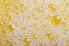 尿中有泡沫，是肾脏出了问题吗？图片