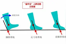 如何纠正扁平足？离不开这5点小知识，使足弓能支撑，走路不太累图片