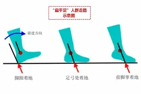如何纠正扁平足？离不开这5点小知识，使足弓能支撑，走路不太累图片