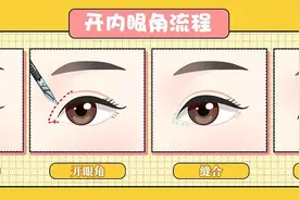 想做双眼皮但又不知道要不要开眼角？哪些症状适合开眼角？图片
