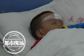 2岁孩子争抢玩具 零件不慎插进颅内3厘米 医生：千万不能自己拔图片