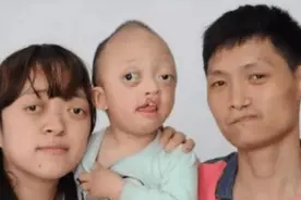 宝宝把奶奶，爸爸，妈妈的缺点全遗传了，丑得不忍直视，值得同情图片
