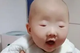 全网眼睛最小宝宝火了，网友：见过眼小的，没见过这么小的图片