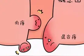 同样是痔疮，为什么他和我不一样？图片