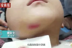 3岁男孩被幼师扔摔缝8针，在幼儿园发生过什么？千万不能这样问图片