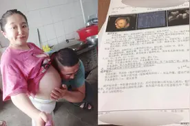 袖珍女孩怀孕后被查出胎儿畸形，拒绝医生为她引产：我想当妈妈图片