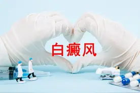 和大家聊聊白癜风图片