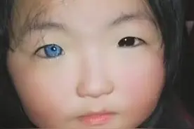 奇事：女孩天生“异瞳‘’，睁眼走红，网友：动漫芭比图片