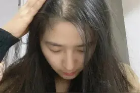 防脱发方法分享图片