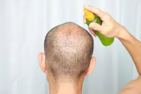 头皮上总能摸到的“小疙瘩”是什么？影响健康吗？本文告诉你答案图片