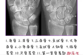 腕关节脱位类型及相关解剖(一)图片