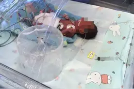 奇迹！福州“巴掌宝宝”半岁啦！背后故事催泪……图片
