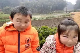 “熊孩子”兄妹玩耍误捅马蜂窝，被蛰成“猪头”，网友：被逗笑图片