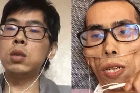 抗癌466天终离世，网红小伙告诉我们：别走太快，等等自己的身体图片