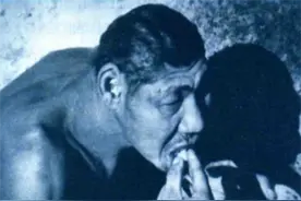 1997年，中科院对“猴娃”进行尸检，研究者：它是小脑症患者图片