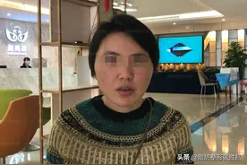 多次整容都失败，找医生修复却接连遭到拒绝，从事医美也一样被坑图片