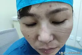 泪目！为方便穿防护服，洛阳80后女护士剪掉齐腰长发图片