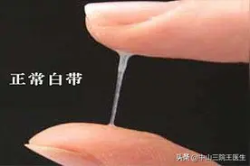 白带是健康的晴雨表，不同的白带都告诉我们哪些信息呢？图片