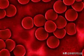 一种新方法揭示了艾滋病如何影响大脑认知功能图片