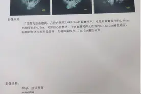 潍坊女子多年不孕数次通液，老主任看到造影：再通你也怀不上图片