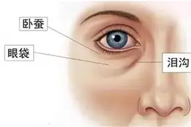 显不显老全看脸，泪沟是首要关键 | 北大教授张宗学图片