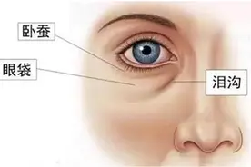 显不显老全看脸，泪沟是首要关键 | 北大教授张宗学图片