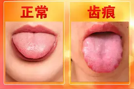 脾胃虚弱湿气重，中医教您健脾祛湿图片