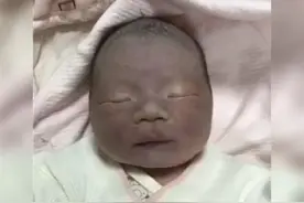 “黑脸宝宝”火了，出生后被全家嫌丑，两个月后颜值逆袭图片