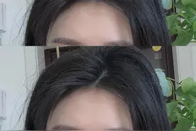看秃头女孩是如何生发的图片