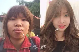 女子结婚前整容，怀孕后出现“变丑”现象，孕期该注意哪些？图片