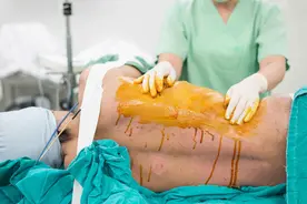 医生手术时，切开患者身体后会做什么？这5个动画，最能说服问题图片