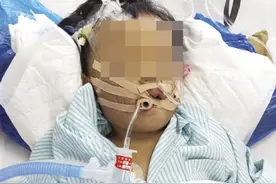 海口2岁女童反复发烧，送医后被诊断出脓毒血症等多种疾病图片