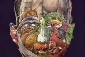 一位医生发的，这是一张阿尔茨海默病测试图，试试能不能找到骆驼图片