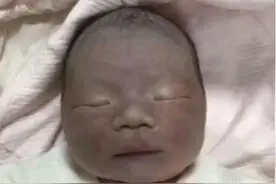 90后宝妈生出“黑脸宝宝”，丈夫数落、婆婆埋怨，医生解释真相图片